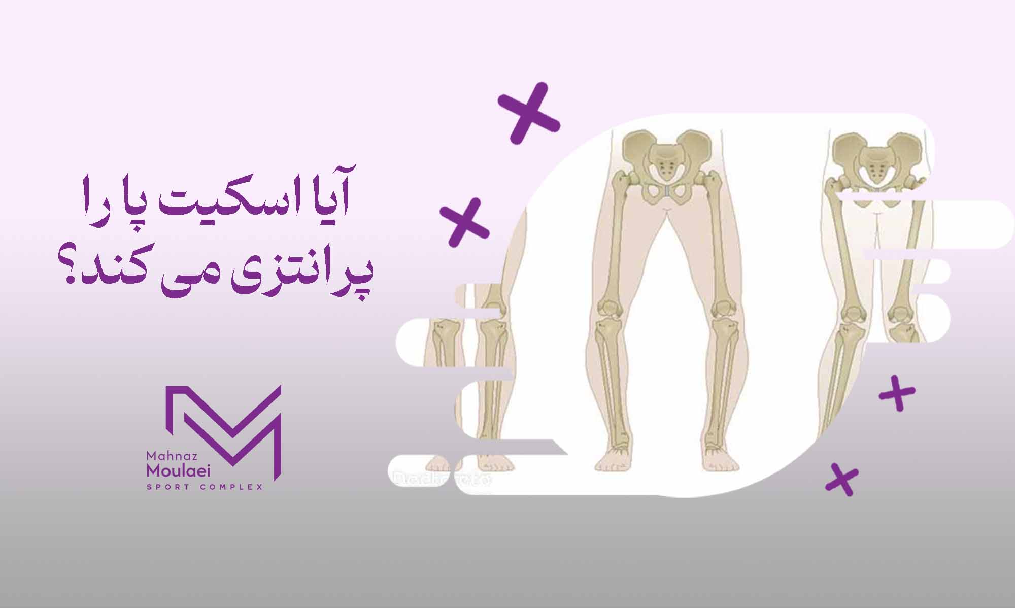 آیا اسکیت پا را پرانتزی می‌کند؟
